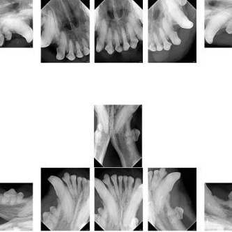 Dentals