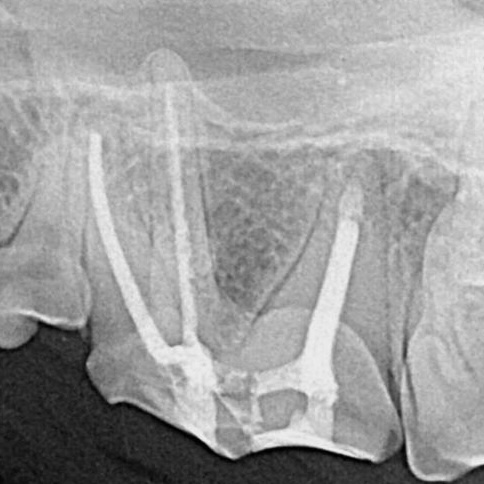 Endodontics