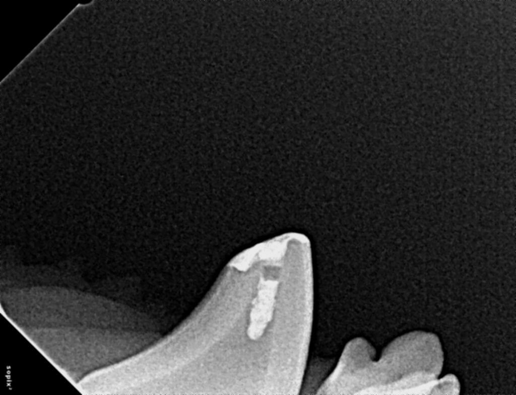 Dental X-Ray