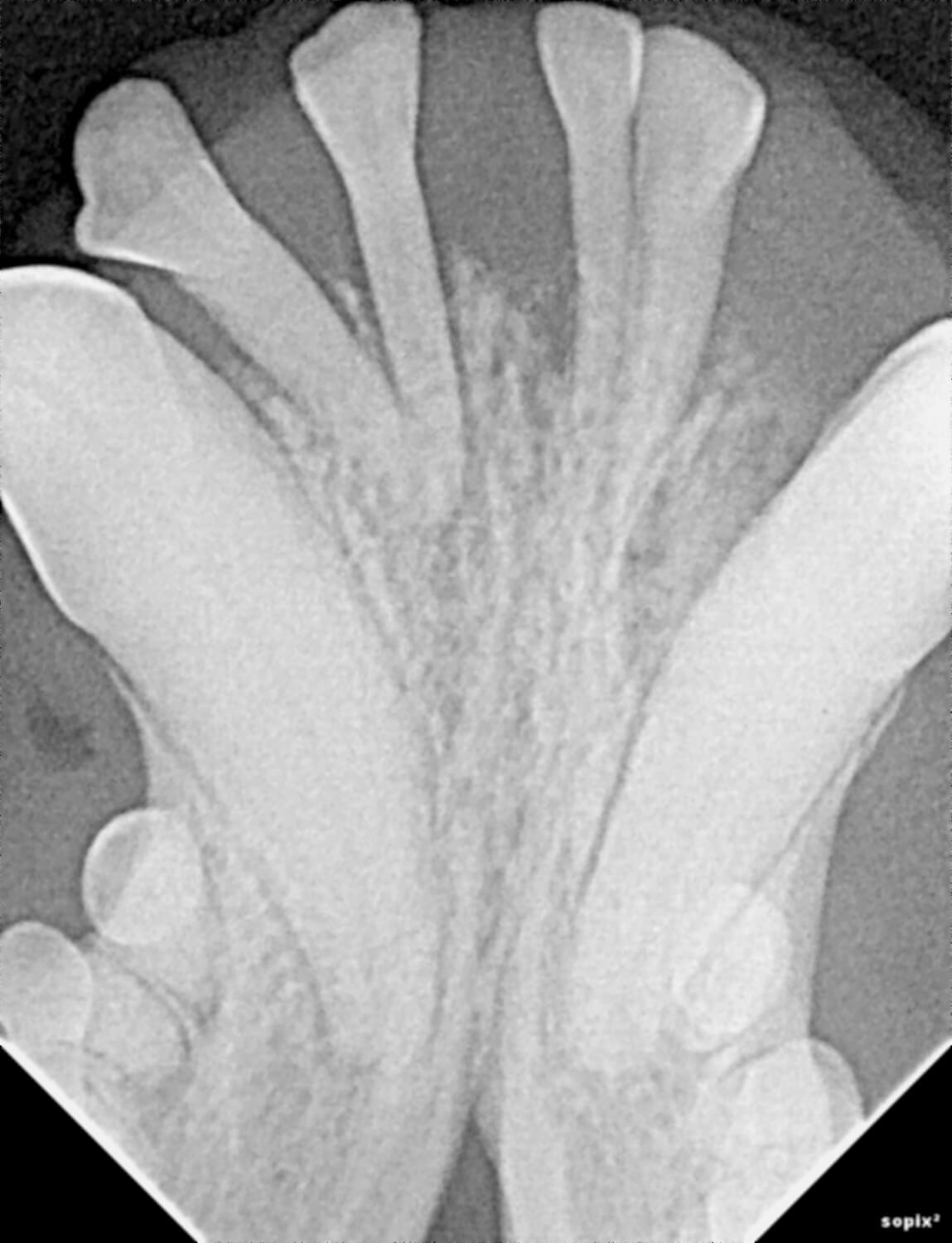 Dental X-Ray
