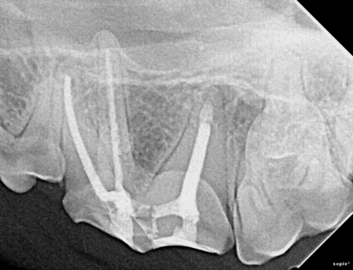 Endodontics