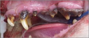 periodontal disease